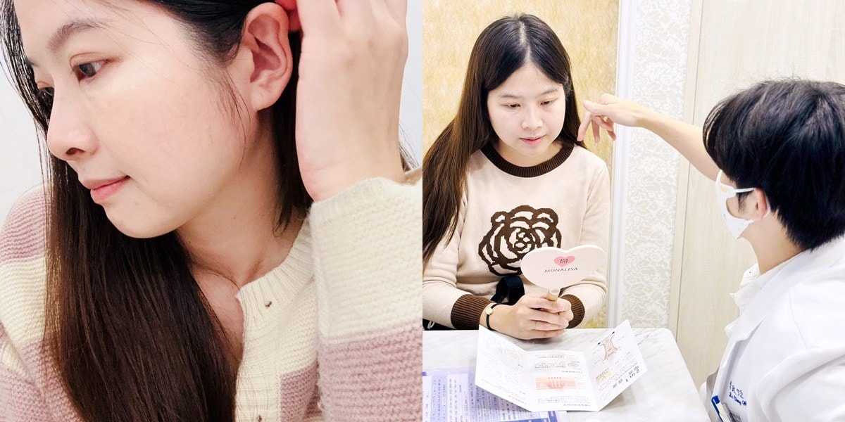 媽咪愛漂亮|電音雙波愛美不再哀哀叫!佳思優醫美診所的緊膚新科技【NEW DOUBLO新倍提】 - 第1張圖