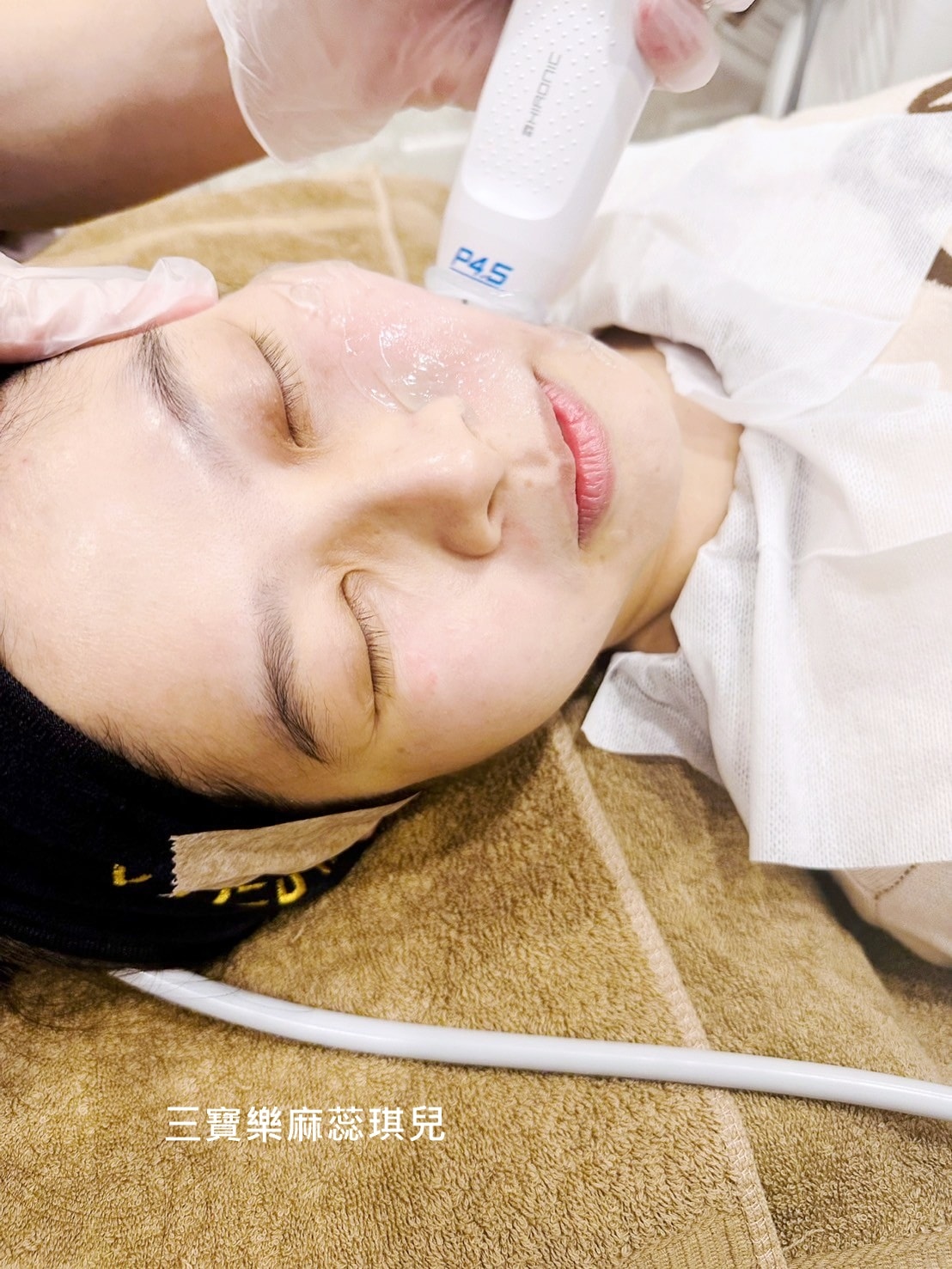 媽咪愛漂亮|電音雙波愛美不再哀哀叫!佳思優醫美診所的緊膚新科技【NEW DOUBLO新倍提】 - 第15張圖