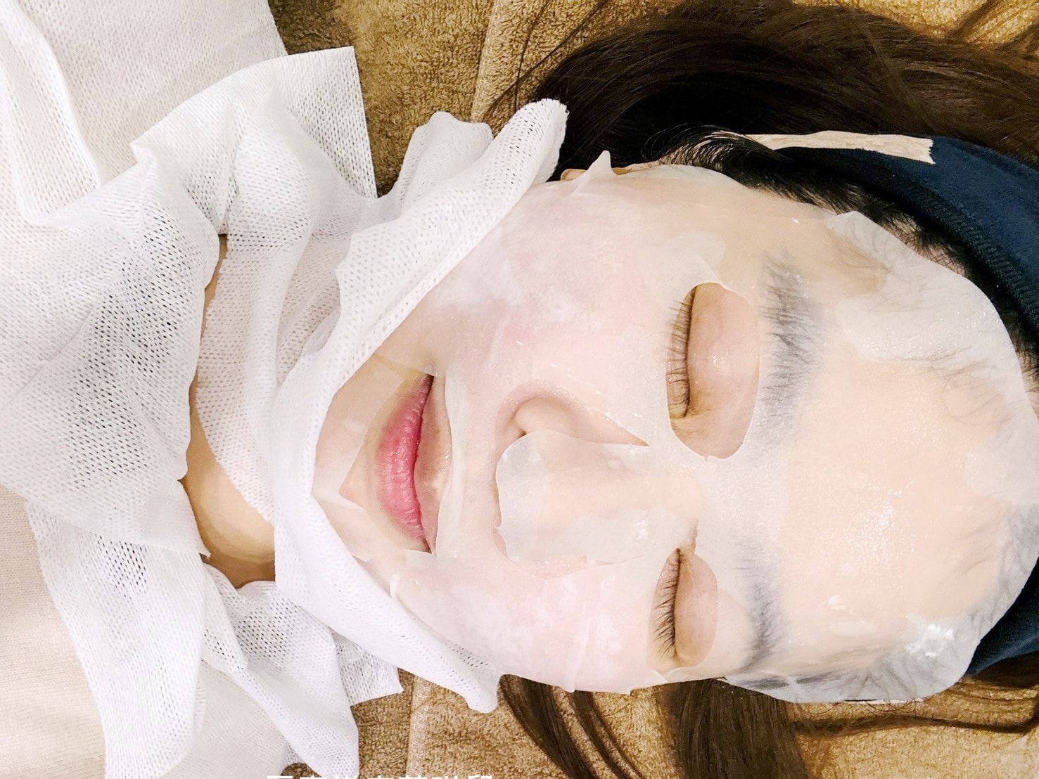 媽咪愛漂亮|電音雙波愛美不再哀哀叫!佳思優醫美診所的緊膚新科技【NEW DOUBLO新倍提】 - 第17張圖