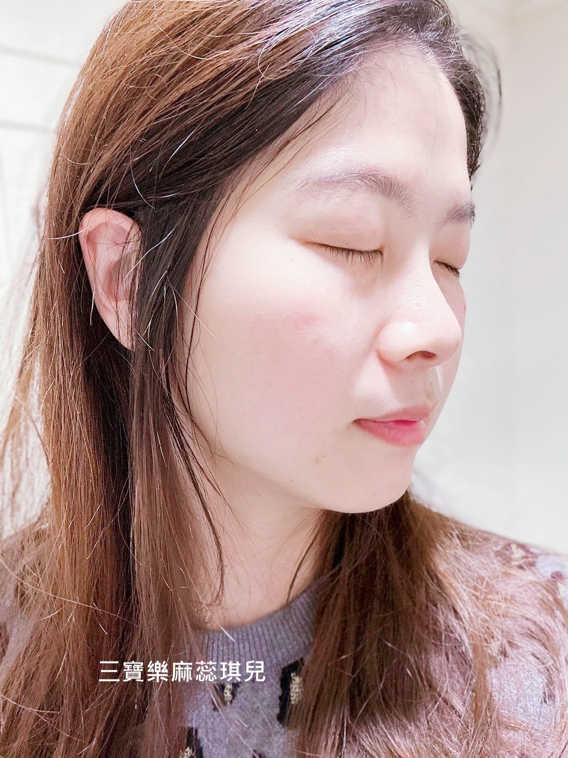 媽咪愛漂亮|電音雙波愛美不再哀哀叫!佳思優醫美診所的緊膚新科技【NEW DOUBLO新倍提】 - 第22張圖