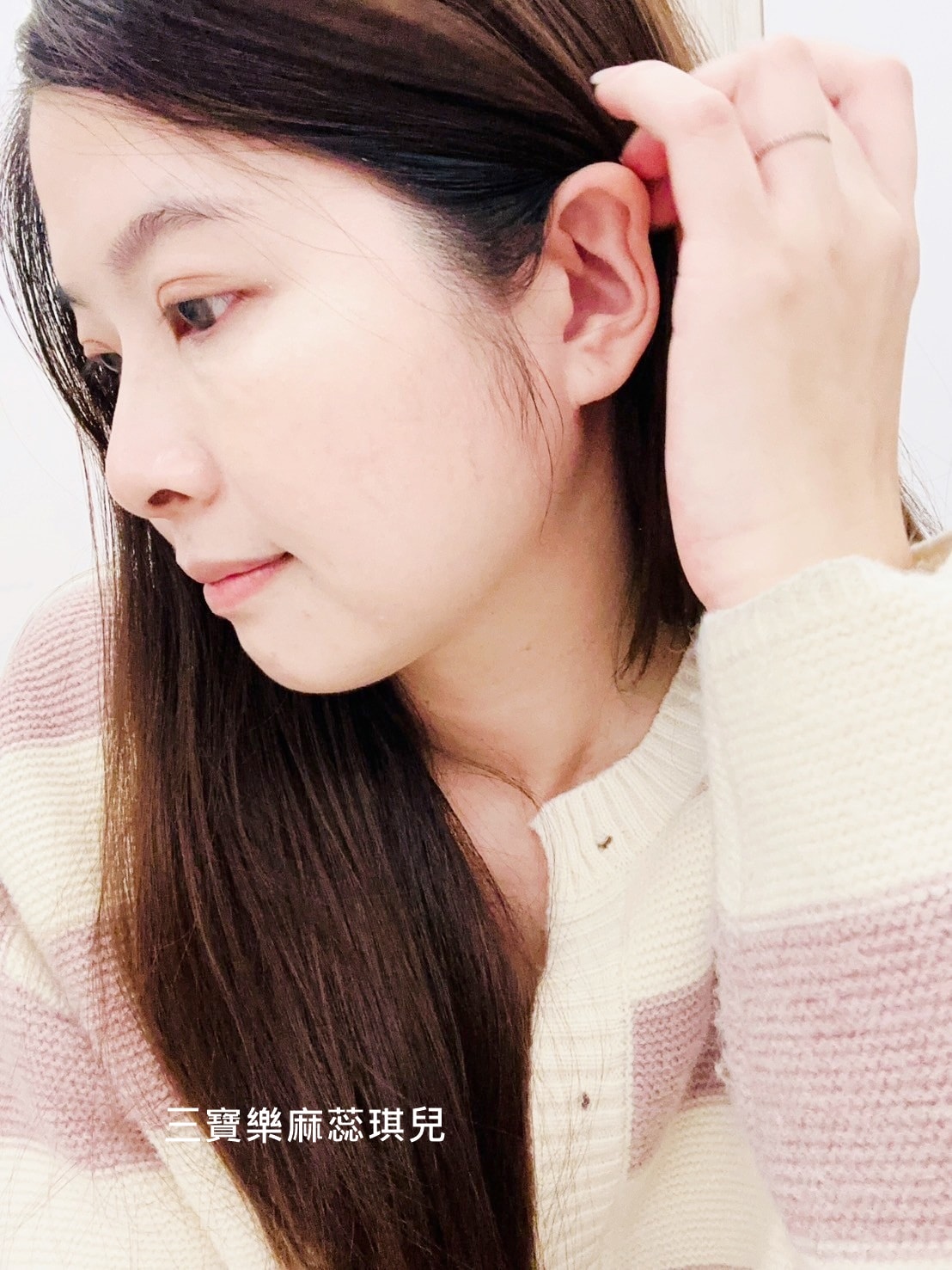 媽咪愛漂亮|電音雙波愛美不再哀哀叫!佳思優醫美診所的緊膚新科技【NEW DOUBLO新倍提】 - 第25張圖